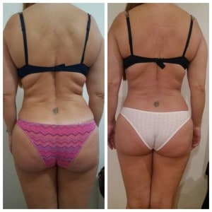 Tratamento Estética Itaim