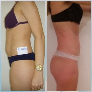 Tratamento de Estetica Moema