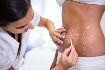 Lipo Enzimatica